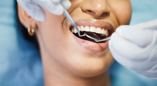 Best Emergency Dental Care for Abscessed Tooth in Newington, VA