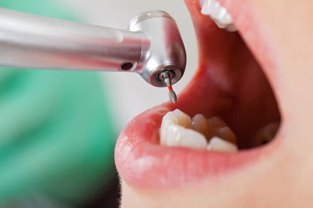 Best Urgent Dental Care for Toothache in Newington, VA